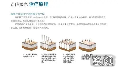 轻质建筑材料销售 第163页